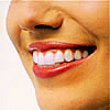 invisalign 3