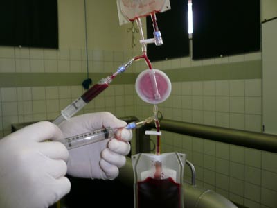 Behandlung von Sehnenentzündungen mit PRP (platelet rich plasma) und Stammzellen