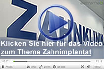 Zahnimplantat-Video der AAZ-Zahnkliniken
