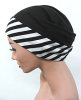 Turbane M�tzen T�cher Kopft�cher Kopfbedeckungen bei Haarverlust Chemo Alopecie Chemotherapie Glatze