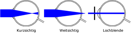 Funktionsweise Rasterbrille