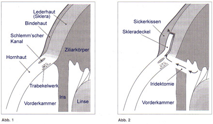 Operationsmethode