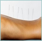 Cabinet Acupuncture