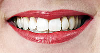 Periodontal Services - dentist grafenwoehr