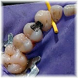Mercury Free & Mercury Safe Dentistry - dental office weiden