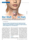 Schilddr&uuml;se