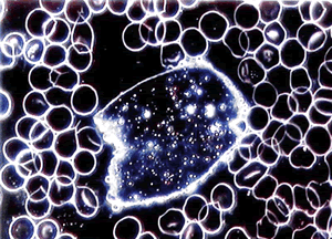 Aspergillus niger Symplast: massive Stoffwechselstörung (degenerative Krankheit)