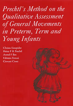 Prechtl�s Method