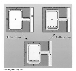 Barotrauma in den Nasennebenh�hlen
