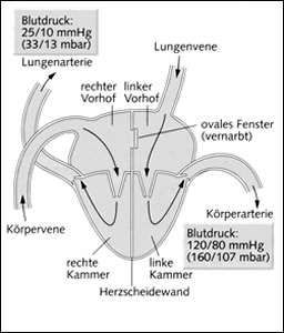 Das menschliche Herz besteht aus zwei funktionell unabh�ngigen Pumpsystemen, dem rechten und dem linken Herz