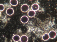 Dunkelfeldaufnahme nach 9 Stunden, massive Entwicklung von hochgradigen krankhaften Mikroorganismen