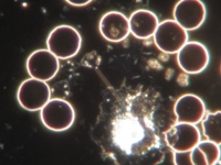 Dunkelfeldmikroskopie Heilpraktiker Uli Haberbosch www.bioprax.de