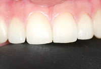 Pink & White Esthetics nacher