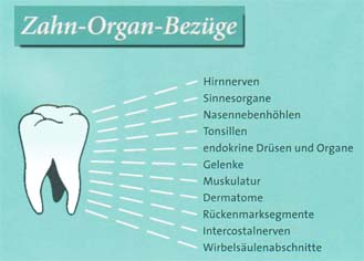 Wechselbeziehung zwischen Z&auml;hnen und Organen waren schon in China bekannt. Die ganzheitliche Zahnmedizin mit naturheilkundlicher Ausrichtung bezieht diese Wechselbeziehungen in die Behandlung mit ein.