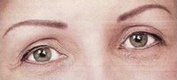 Permanent make-up f�r strahlende Augen - Die Brauen wurden mit der H�rchentechnik und einer kleinen Unterschattierung pigmentiert. So sehen sie nat�rlich aus und erhalten eine optimale Form. 