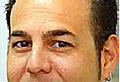 Botox - vorher