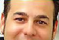 Botox - nachher