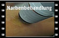 Narbenbehandlung