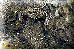 Hautschuppen