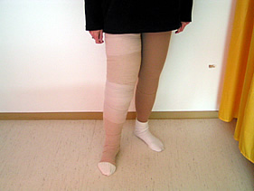 Bandagierung bei Lymphdrainage