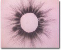 ETD esogetische Terminalpunkt-Diagnostik (Kirlian)