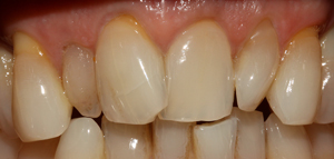 http://images.worldsoft-cms.info/wcms/ftp/z/zahnarzt-balan.de/siteimages/2383.jpg