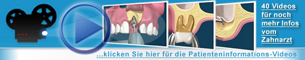 Zahnarzt-Videos für noch mehr Informationen der Zahnpatienten