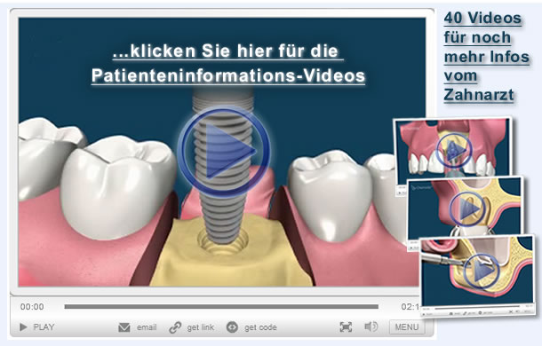Zahnarzt-Videos f&uuml;r noch mehr Informationen der Zahnpatienten