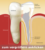 Wurzelf�llung