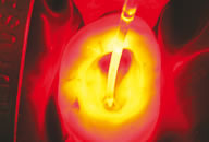 Dentallaser