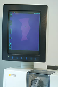 CEREC Bildschirm