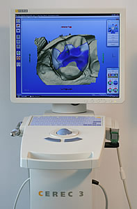CEREC Ger&auml;t