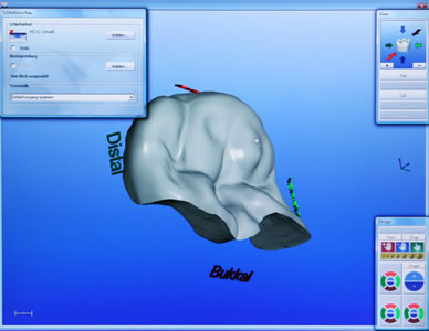 CEREC Bildschirm