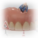 Parodontosebehandlung