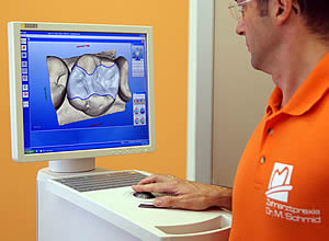 Cerec 3D computergest&uuml;tzte Rekonstruktion, Zahnarzt Dr. Schmid, Zahnarztpraxis in Weiden